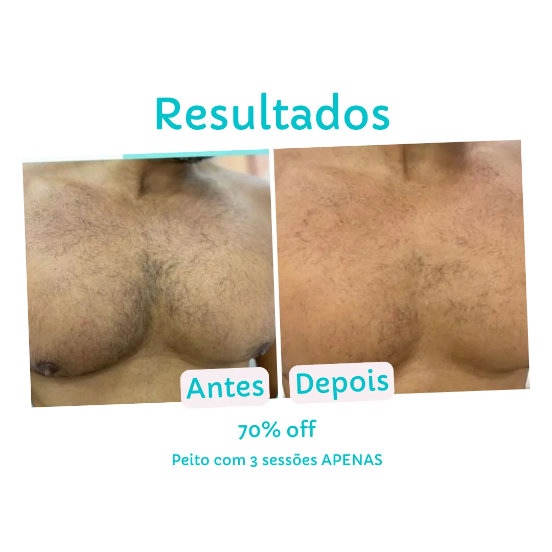 Resultado Peito